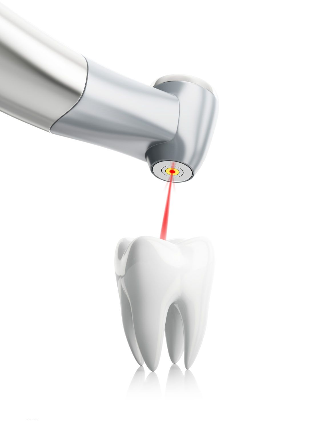Zahnbehandlung mit Laser Zahnarztpraxis Dentanova