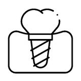 Icon dental implant